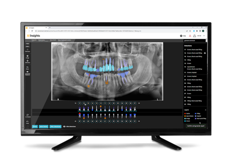 keyfeature information in box